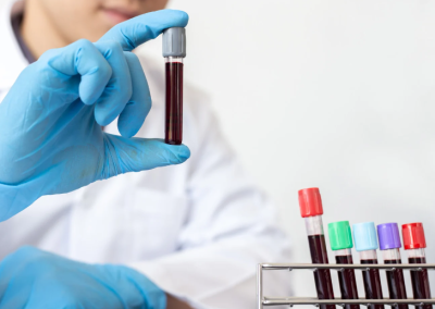 Analiza laboratorijskog nalaza