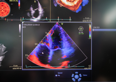 Analiza ultrazvučnog nalaza